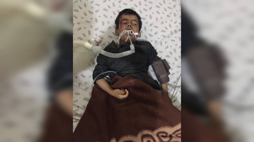 یک کودک در فاریاب مجروح شد